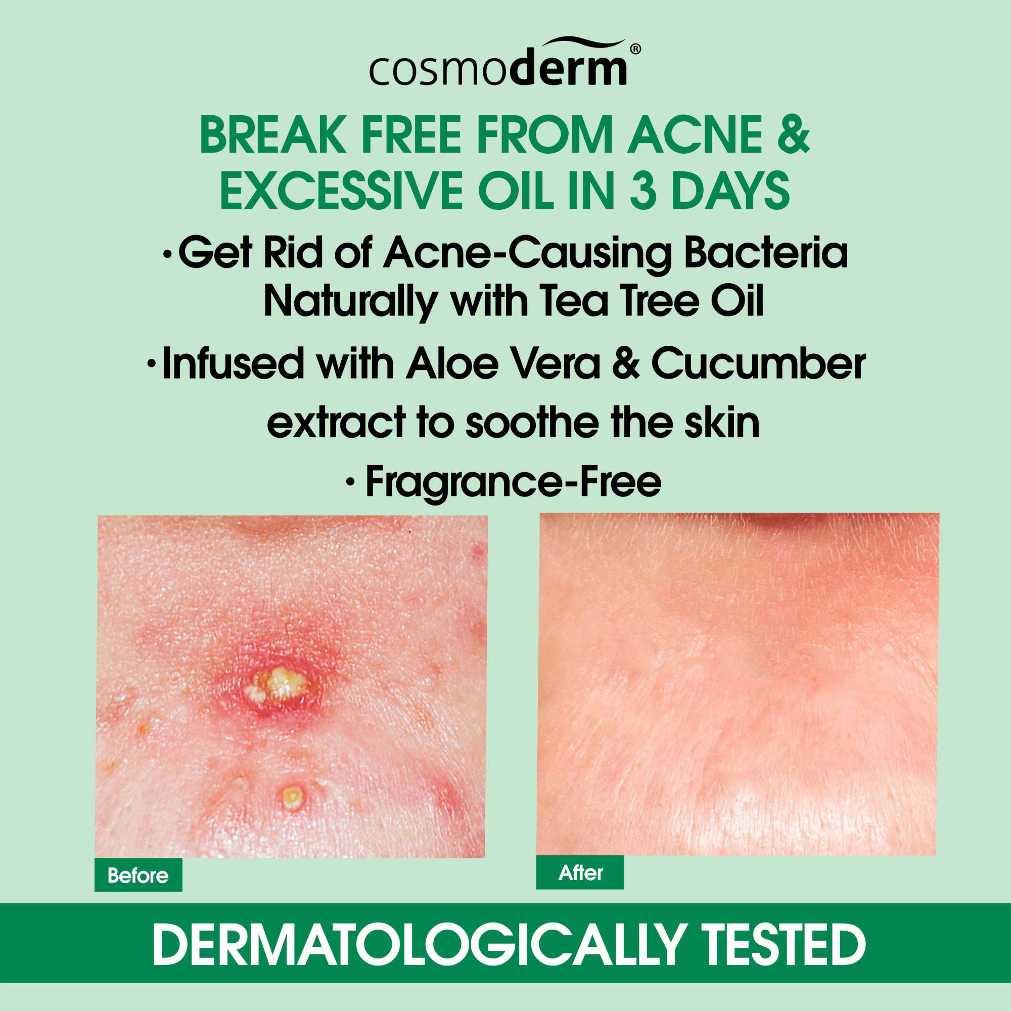 Cosmoderm Tea Tree Oil Clarifying Face Toner 100ml