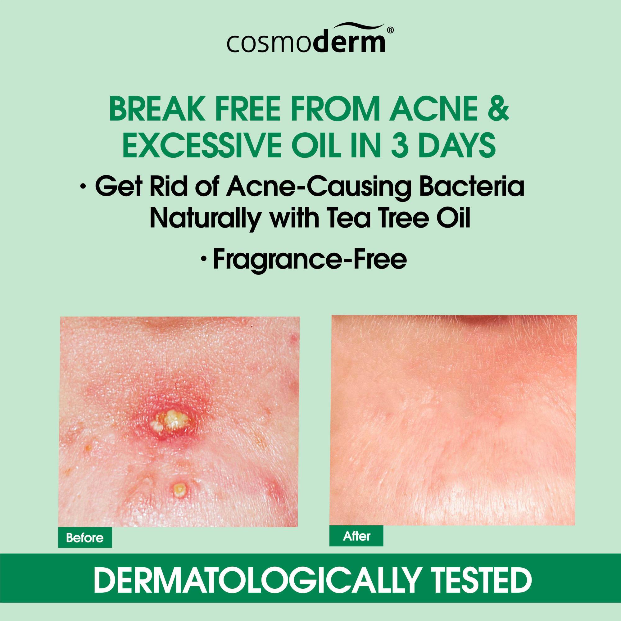 Cosmoderm Tea Tree Oil Purifying Facial Mask 100ml