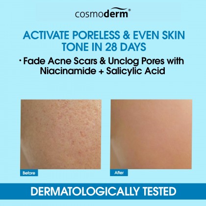 Cosmoderm Niacinamide 10% Salicylic Acid 1% 28 Days Boosting Serum 30ml.